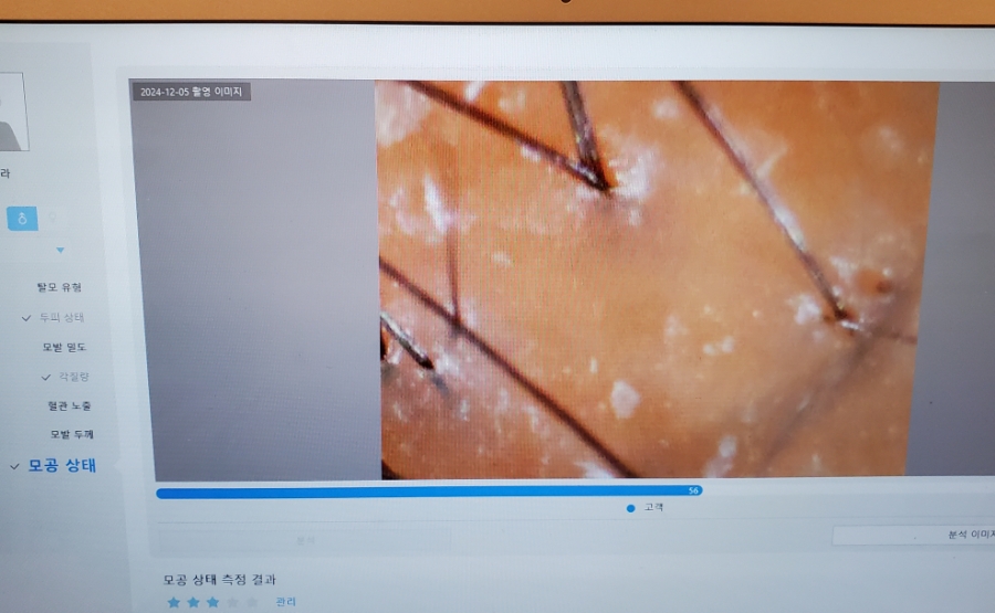 숲칼프가산두피탈모전문센터 이미지