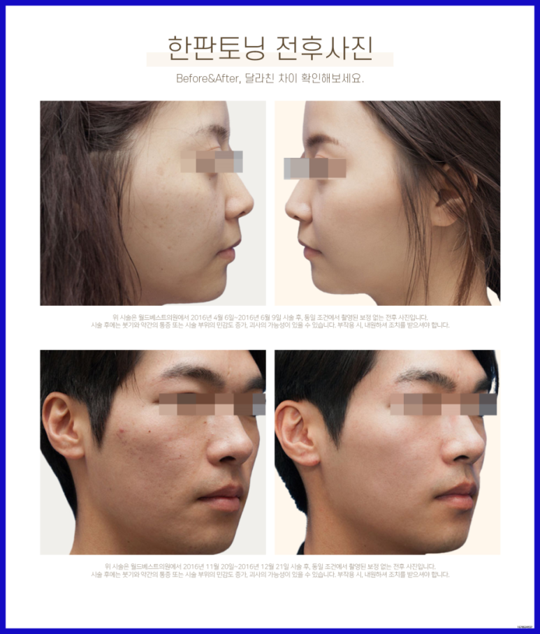착한피부과 이미지