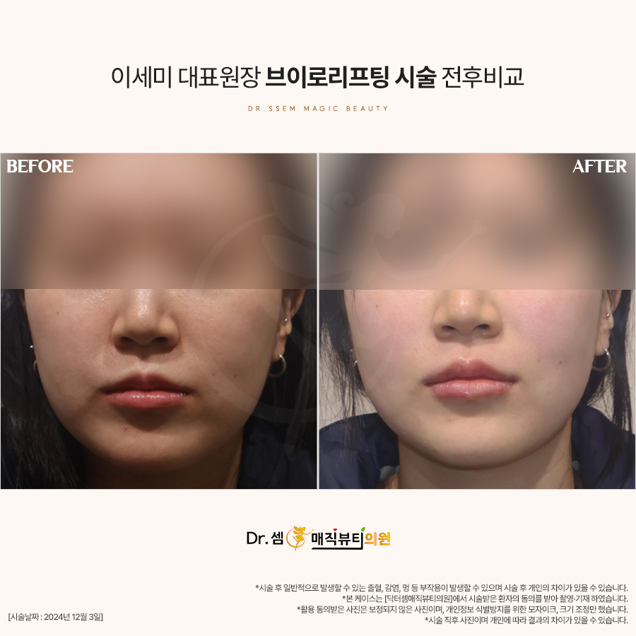 닥터셈매직뷰티 이미지