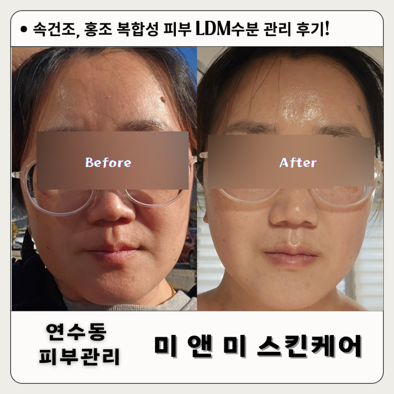 미앤미 스킨케어 이미지