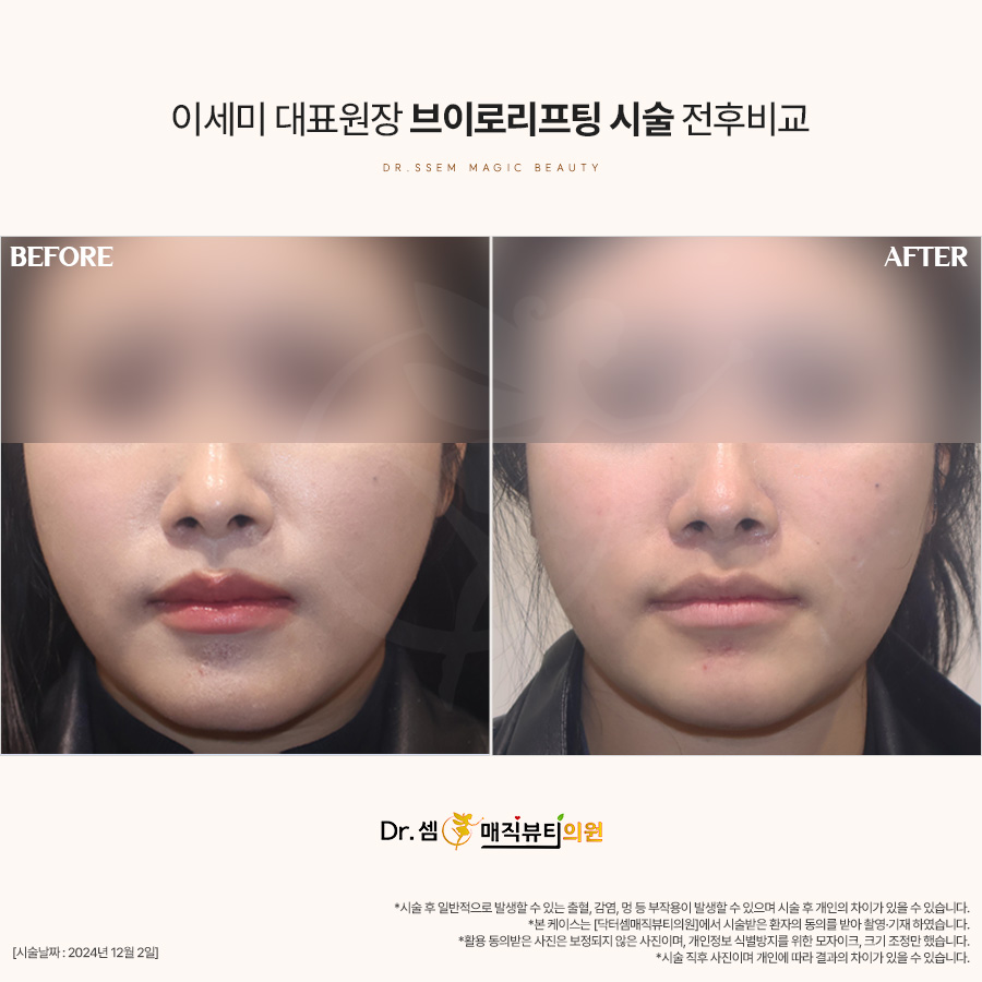 닥터셈매직뷰티 이미지