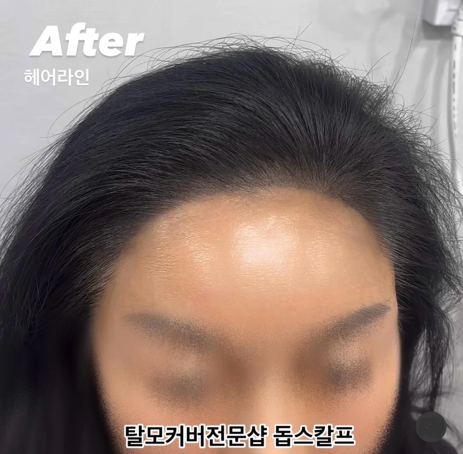 돕스칼프 이미지