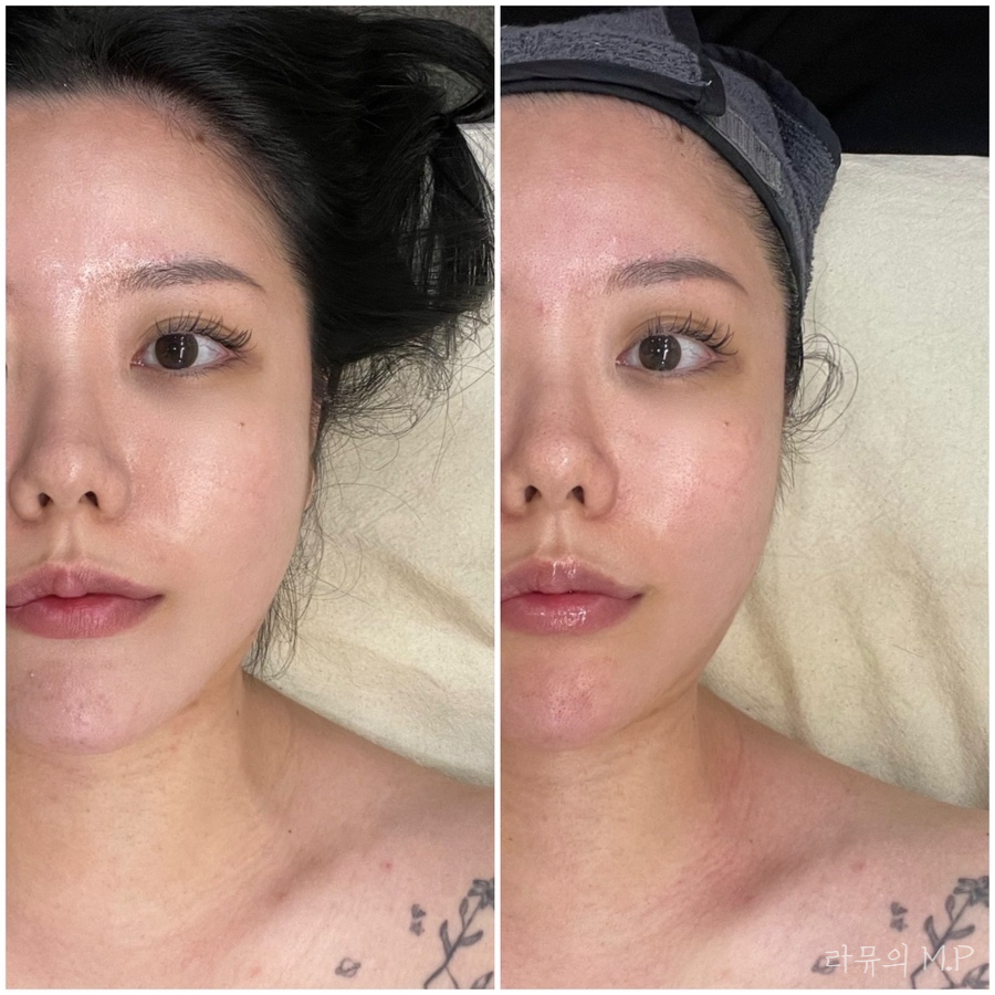 진스케어 이미지