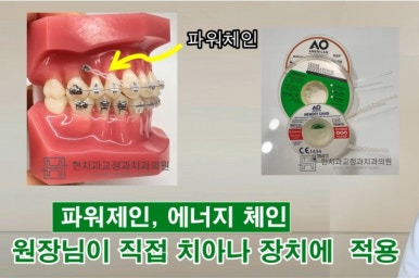 현치과교정과치과의원 이미지