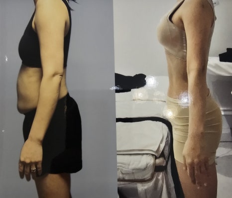 스무살에머물다피부미용학원 이미지