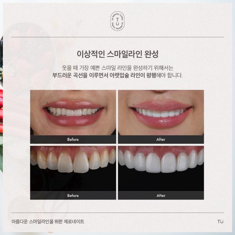스마일100치과 이미지