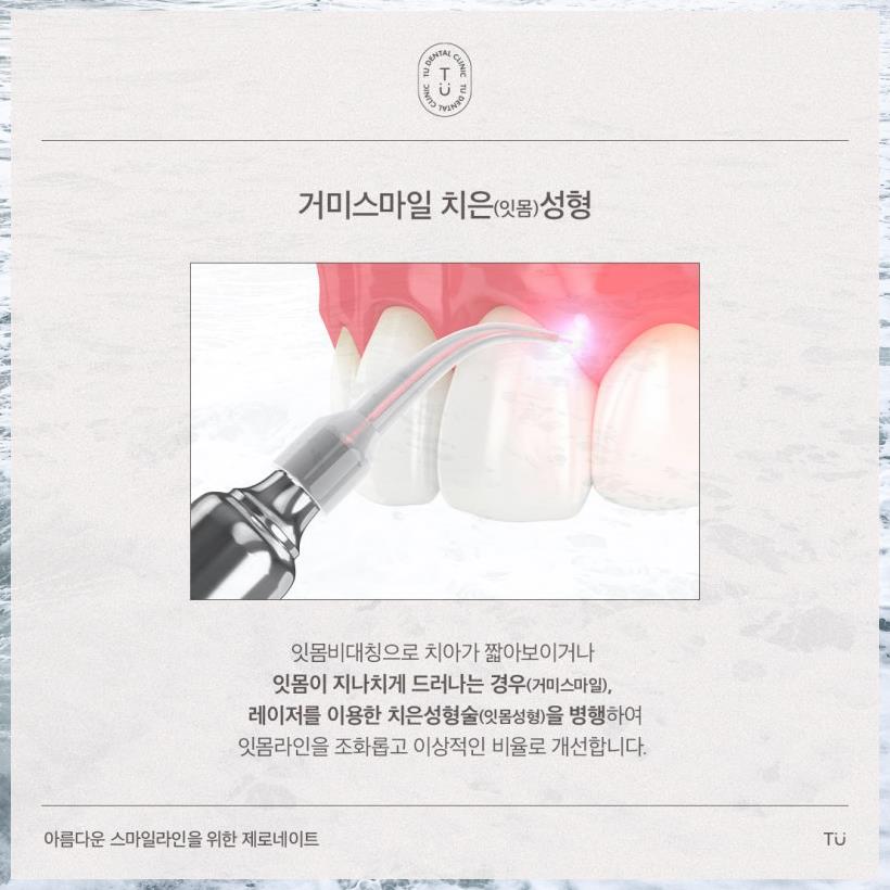 스마일100치과 이미지