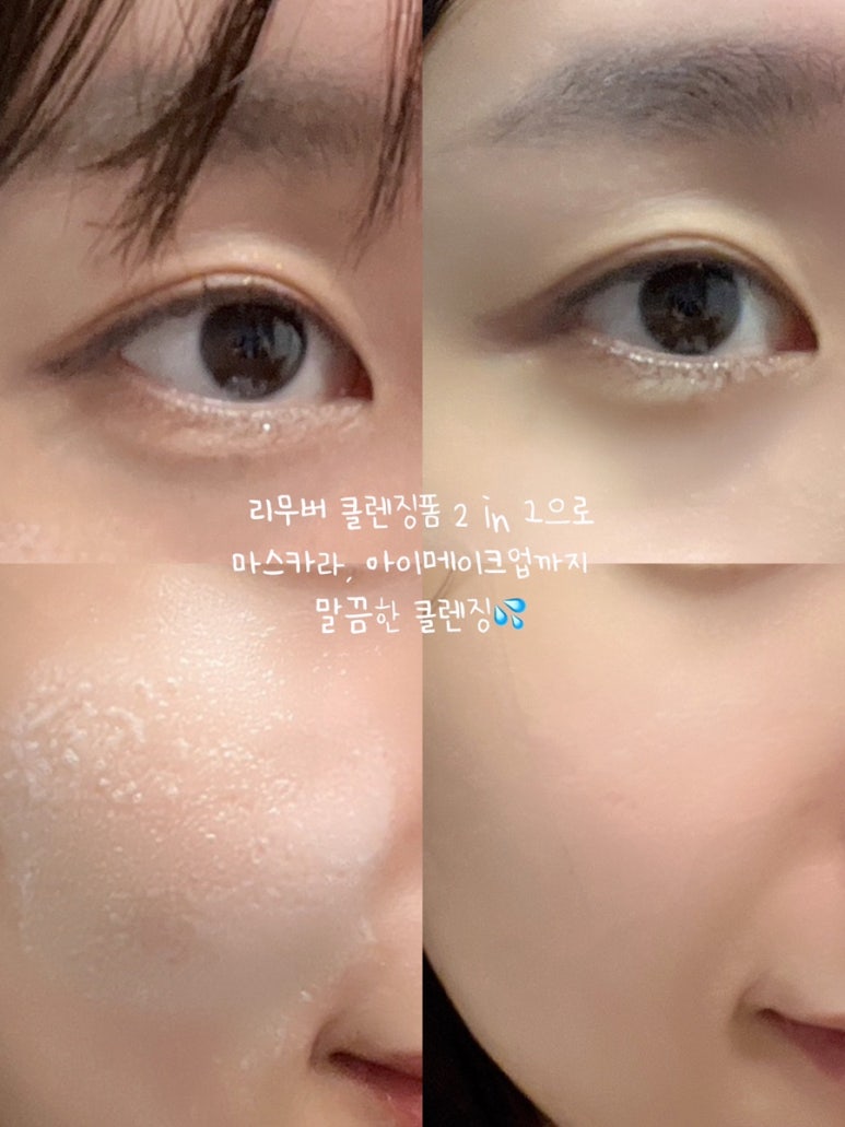 폼2 이미지