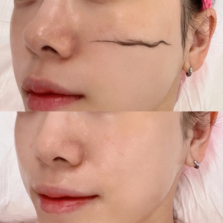 이뉴헤어 이미지