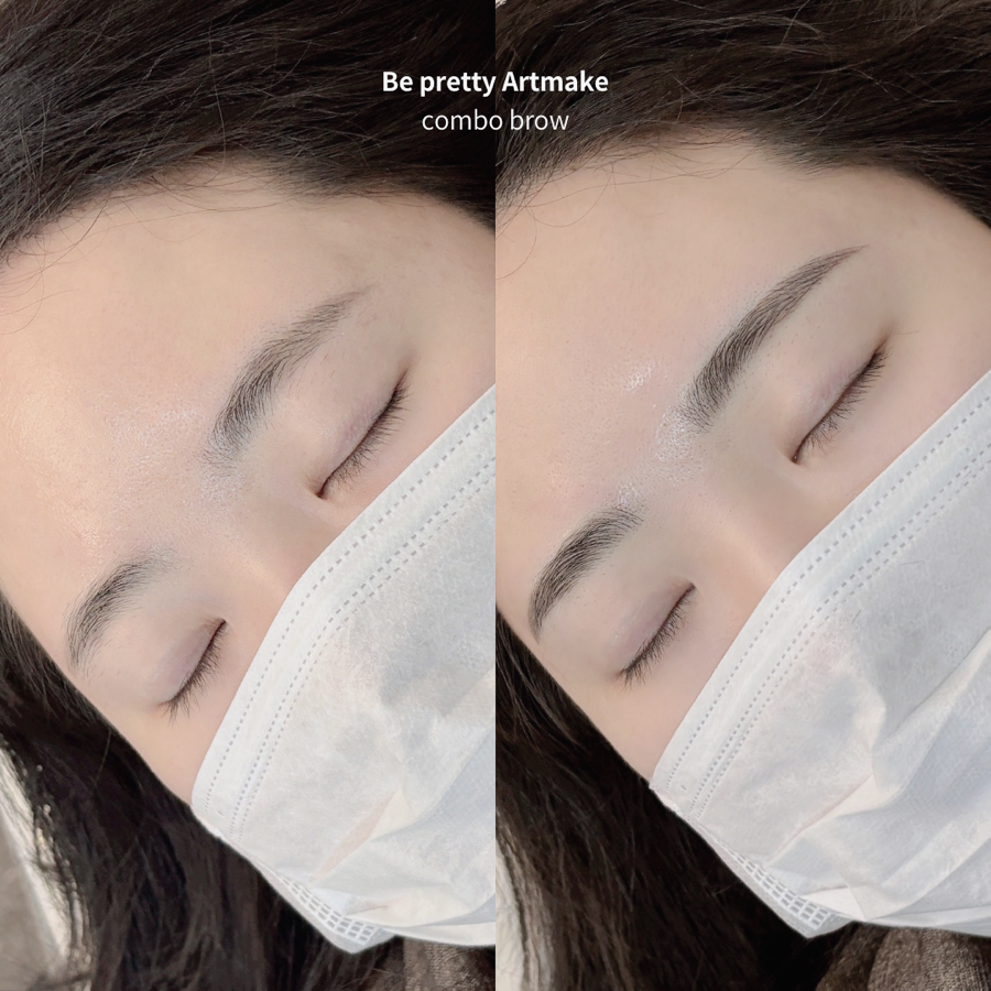 비프리티 이미지