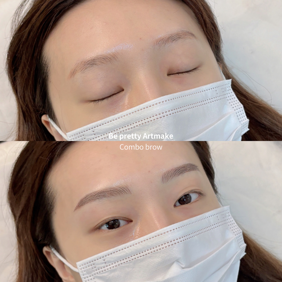 비프리티 이미지