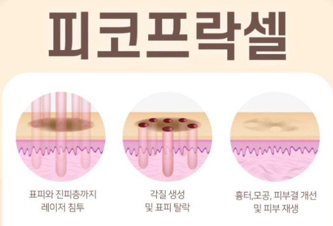 피코 이미지