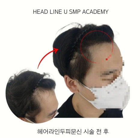 헤드라인유 이미지