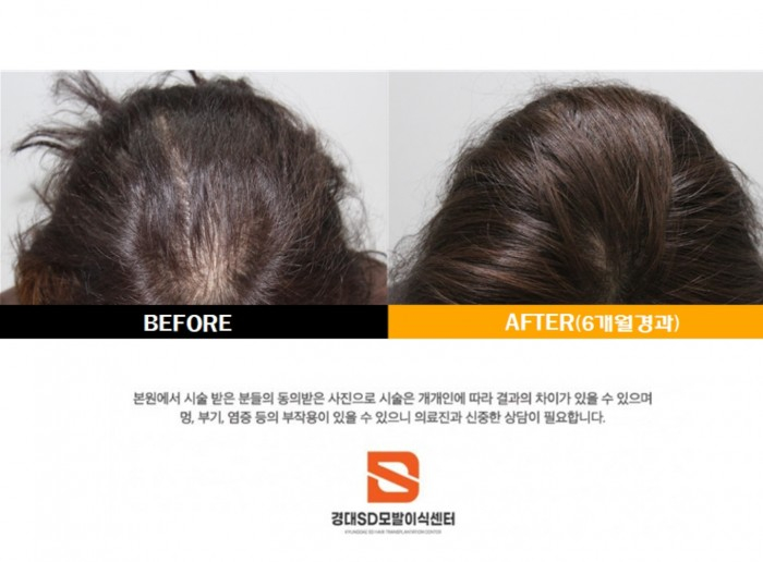 헤어젠 이미지