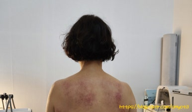 몽힐링케어 이미지