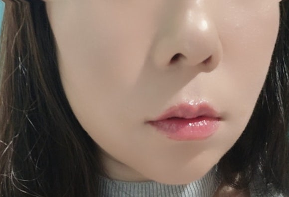 셀럽메디스킨 이미지
