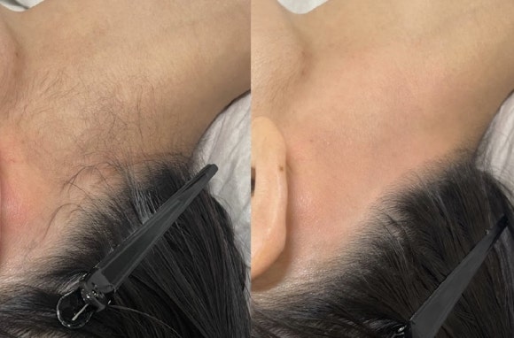 헤어아르니 이미지