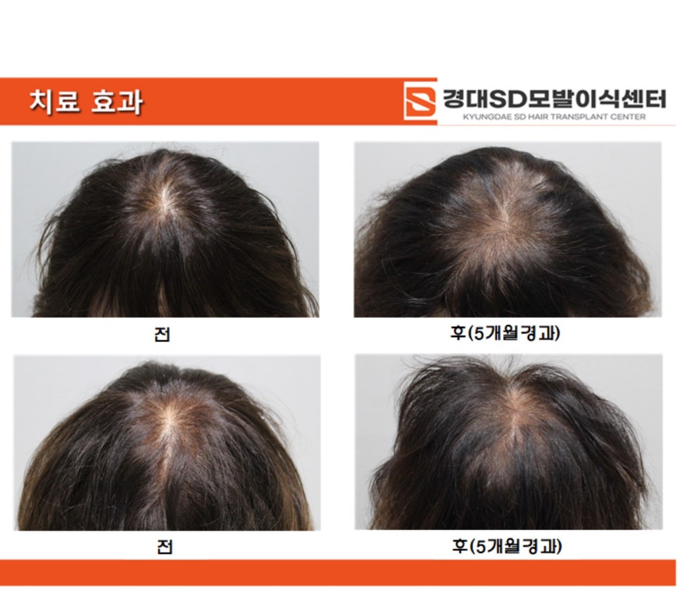 헤어젠 이미지