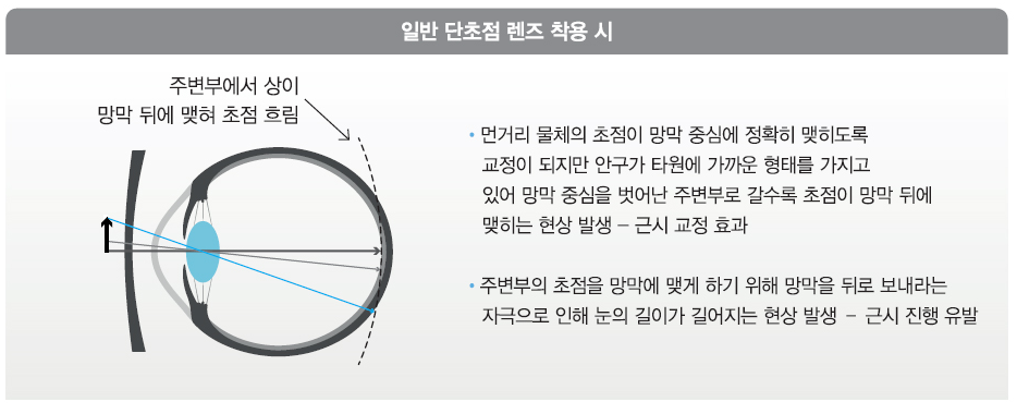 마이오 이미지
