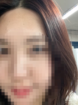 류헤어라인 이미지