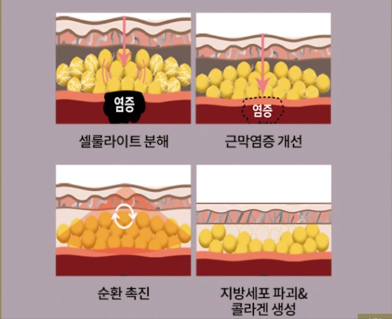 문샵 이미지