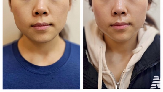 라라샵까치산역점 이미지