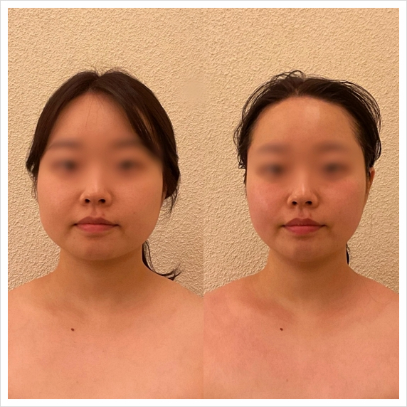 셀핏 이미지