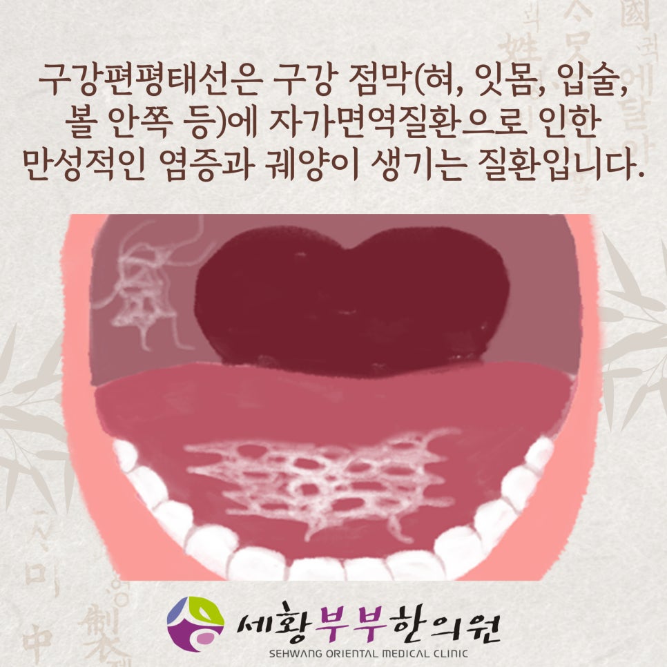 태선위생 이미지