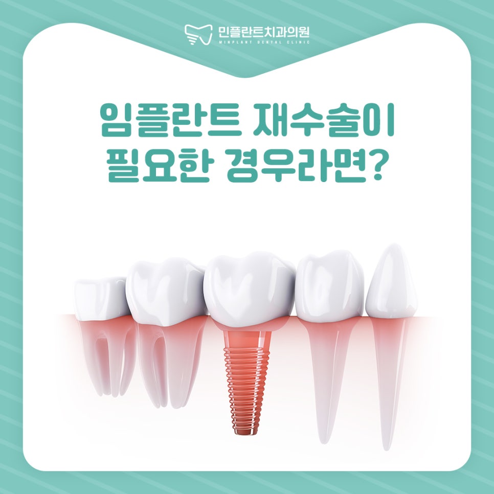 민플란트치과의원 이미지