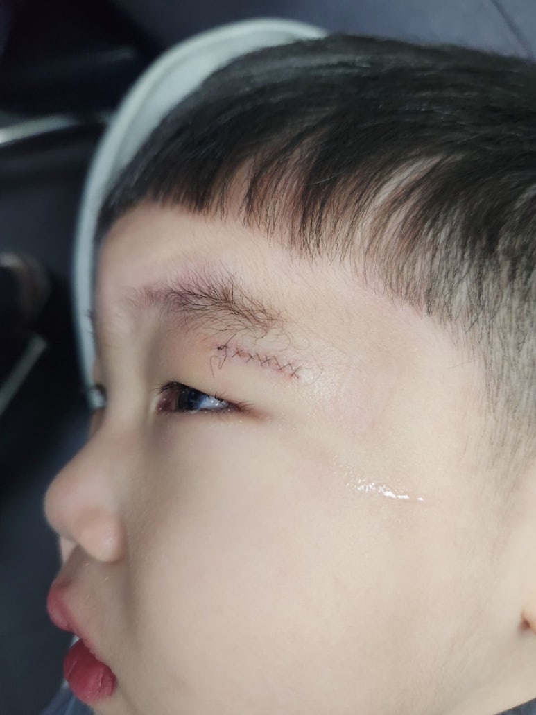 이민녕성형외과 이미지