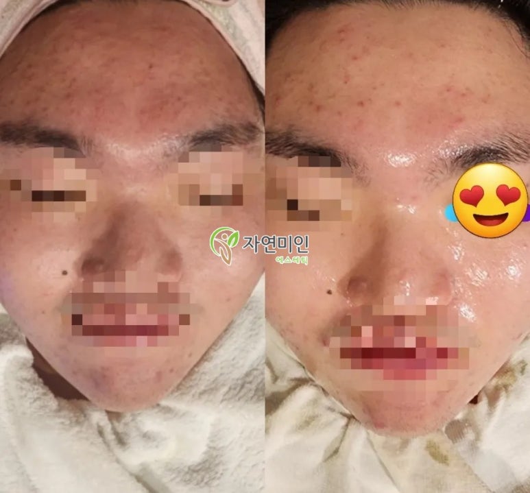 데코텍 이미지