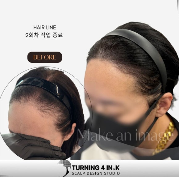 헤어라인 이미지