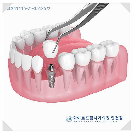 아름다운차이치과 이미지