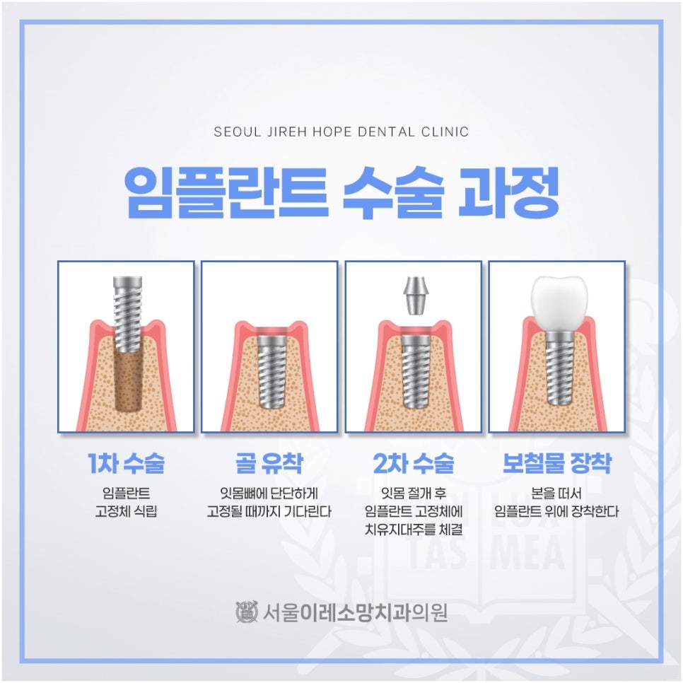 이레치과 이미지