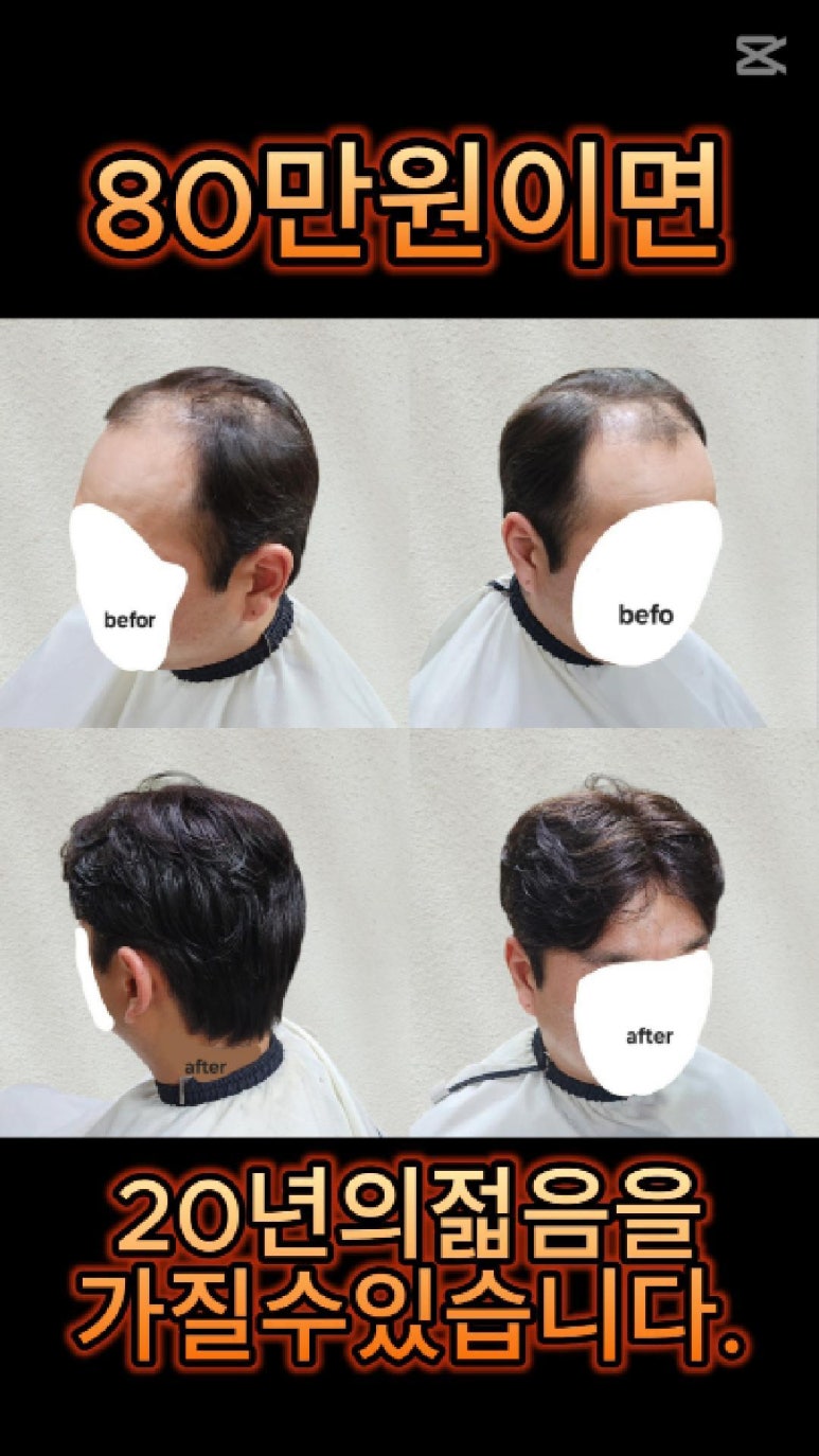 민재가발 이미지