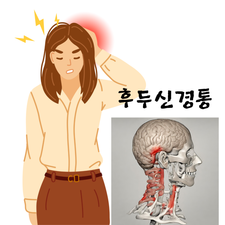 문샵 이미지