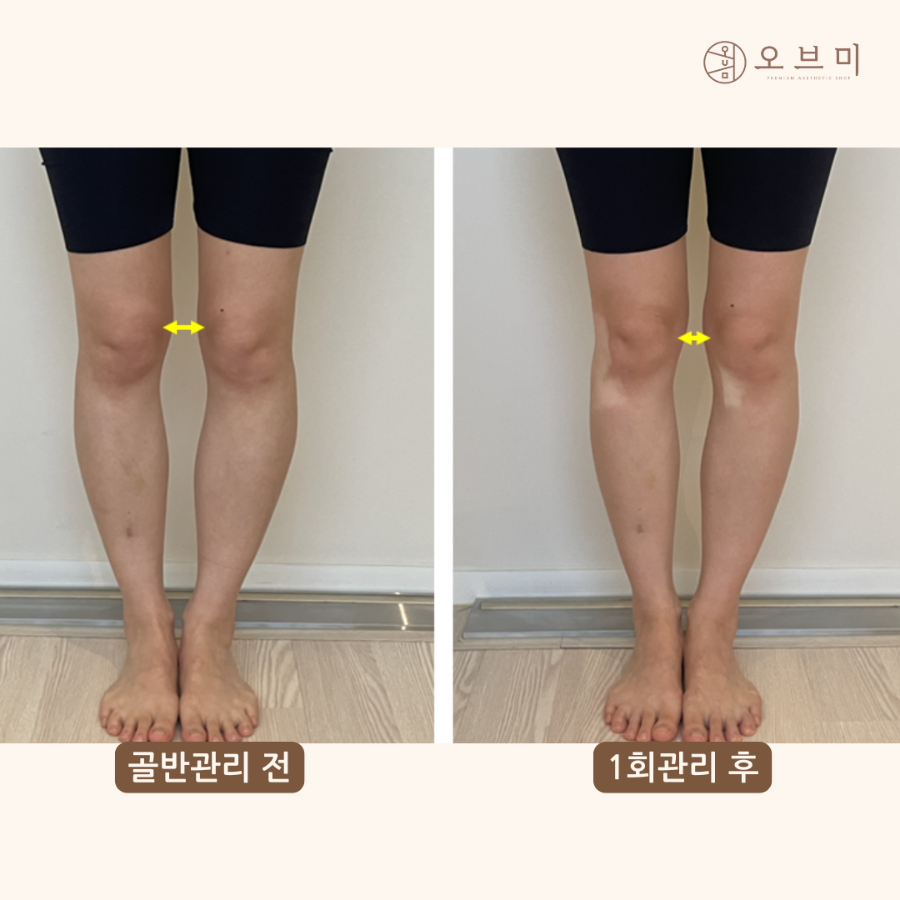 오브마곡 이미지