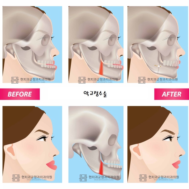 올바른현치과 이미지