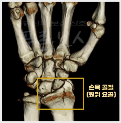 낙상창고 이미지