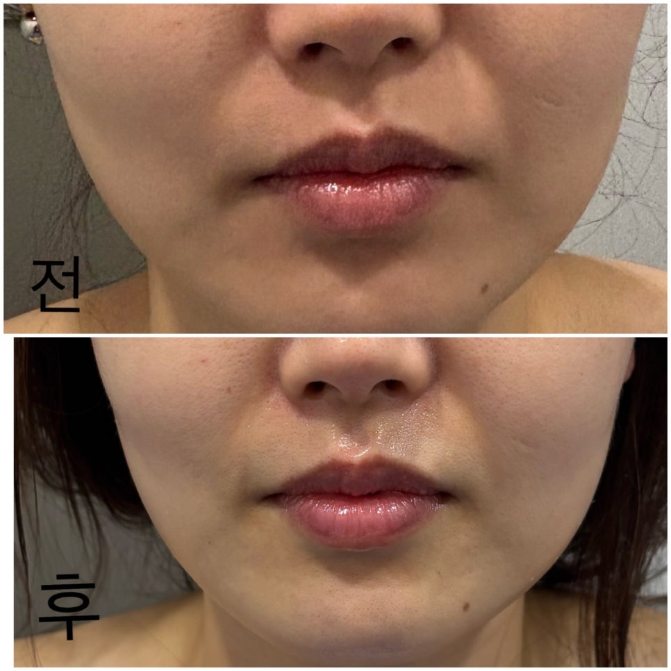광주상무점 디바스킨 이미지