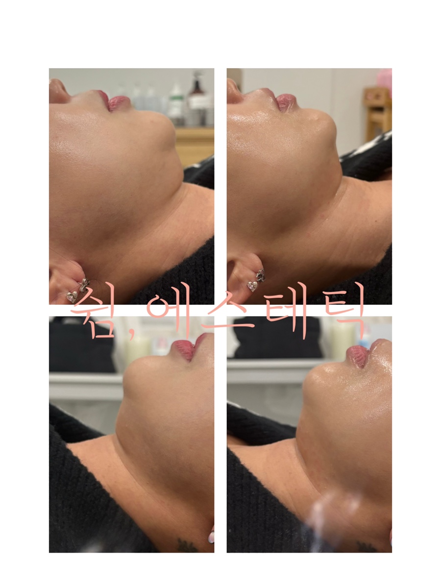 더쉼에스테틱 이미지