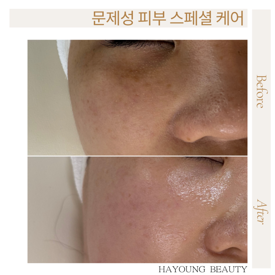 하영피부관리 이미지