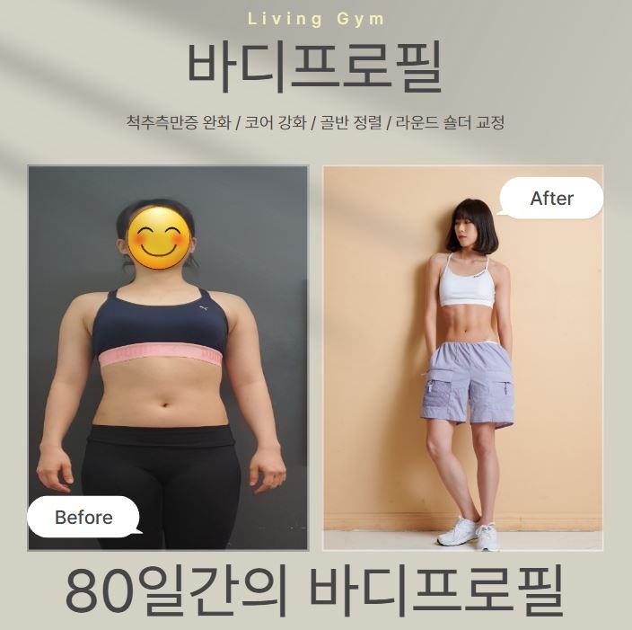 리빙짐 이미지