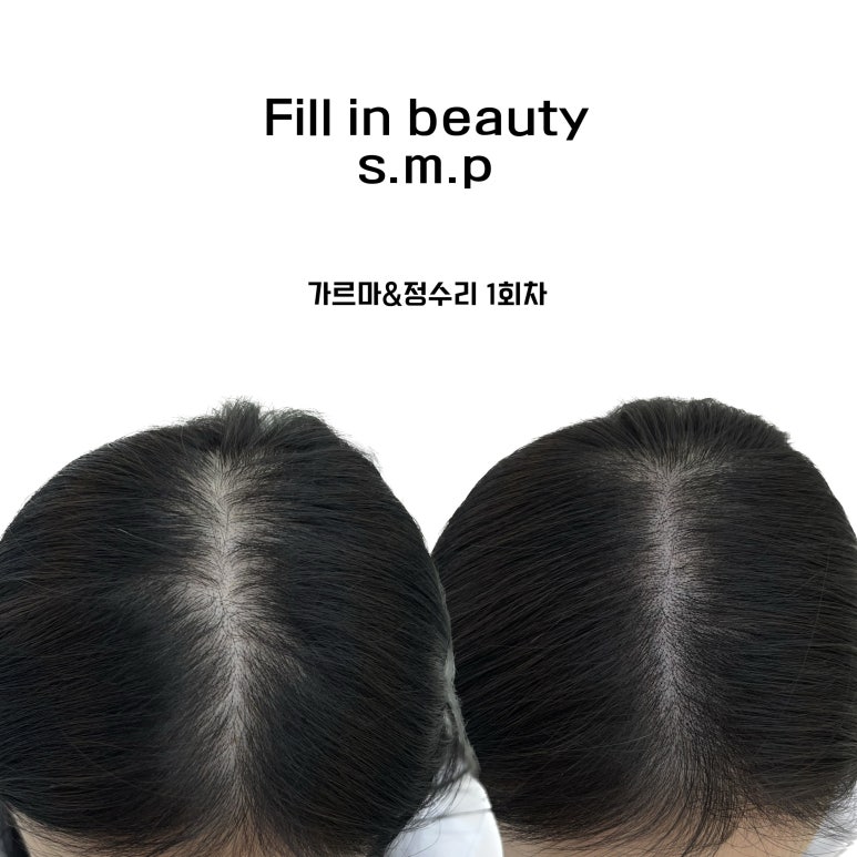 필인브로우&래쉬 이미지