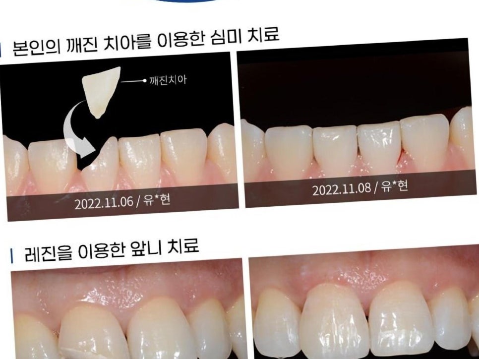 연세웃는치과의원 이미지