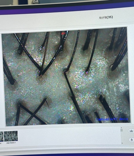 모클락 이미지