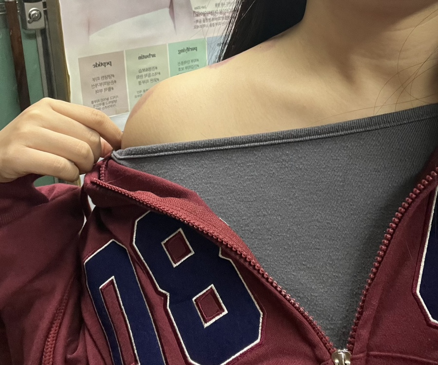 영스킨케어 이미지