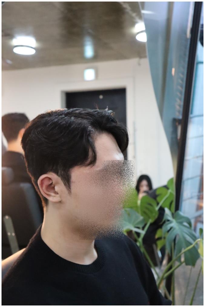 연희헤어라인 이미지