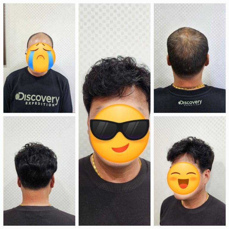전주동안가발 이미지