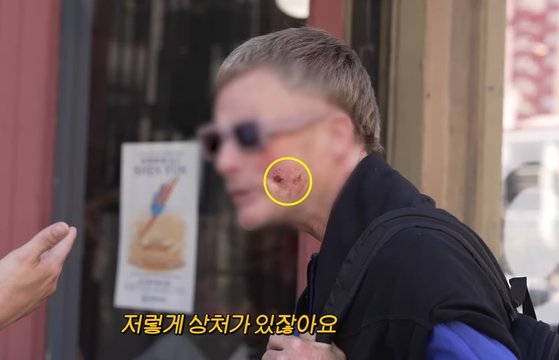 텐더로인 이미지